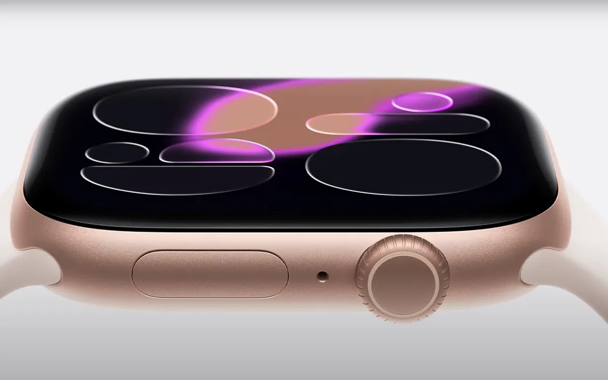 Apple Watch Series 11 01